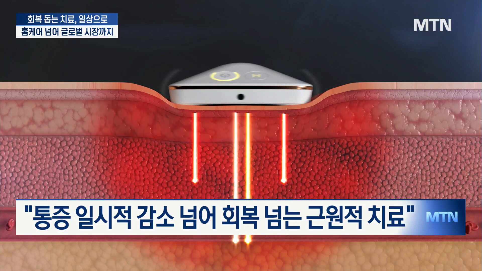"병원급 치료를 일상에서 구현"...웰스케어, 'K-메디컬'로 도약 - 뉴스 썸네일 이미지
