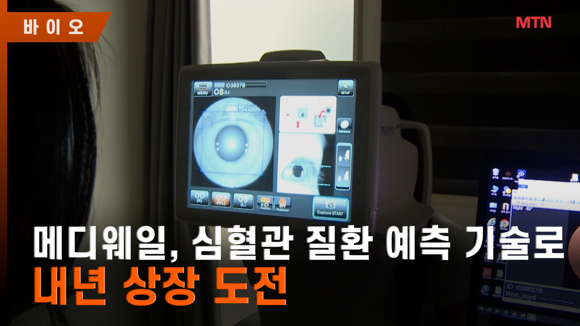 최태근 메디웨일 대표 "망막으로 심혈관 질환 예측...내년에 상장" [바이... - 뉴스 썸네일 이미지