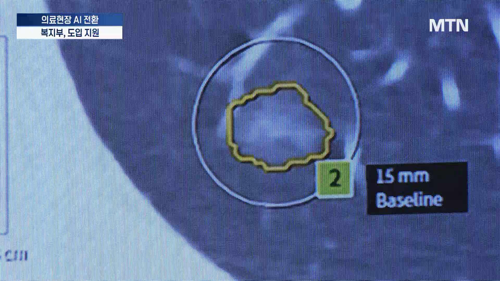 의료현장에 부는 AI 바람…복지부, AI 전환 가속화