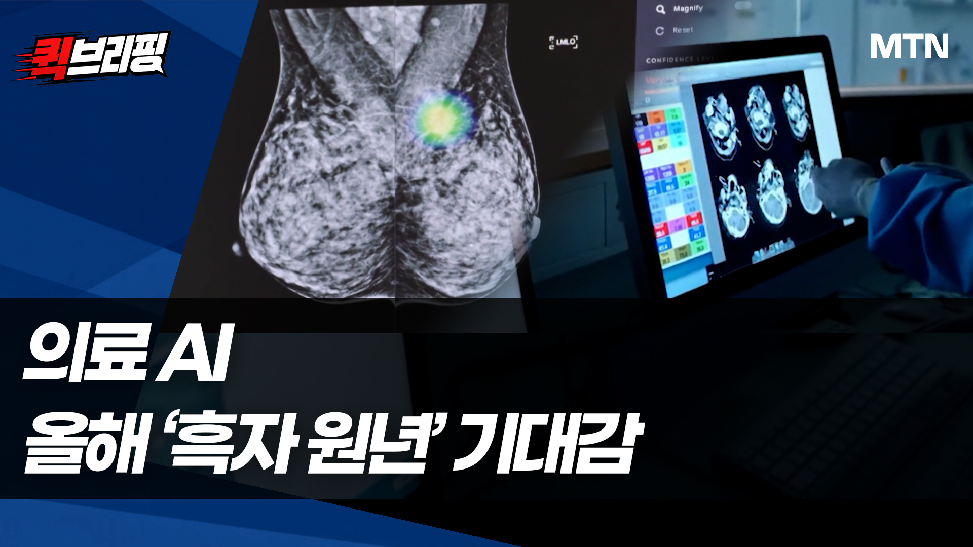 의료 AI, 올해 '흑자 원년' 기대감